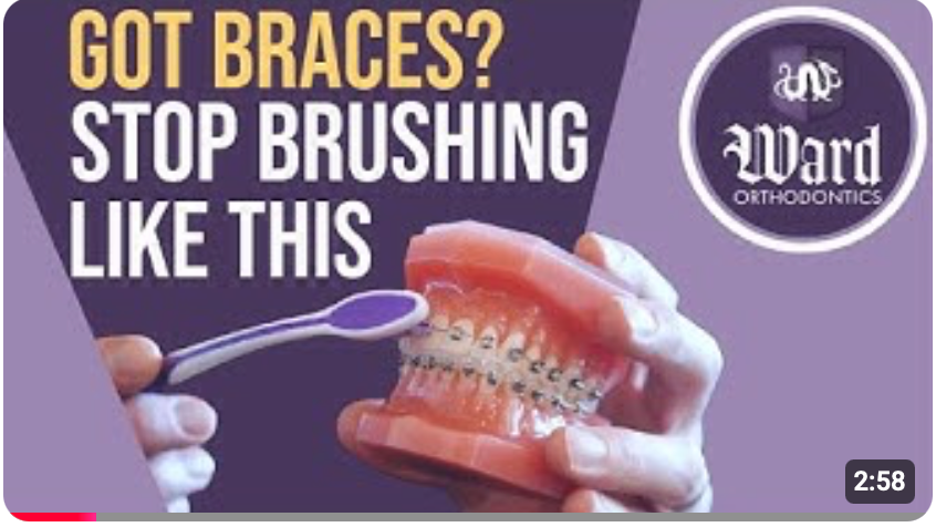 How to brush your teeth properly with braces